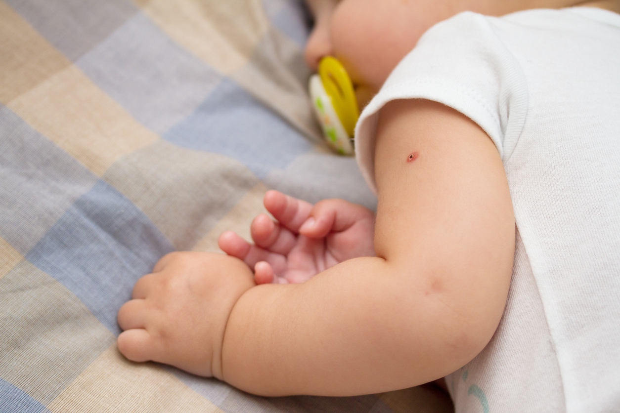 enfant tuberculose