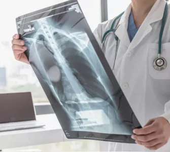 médecin regardant une radio des poumons